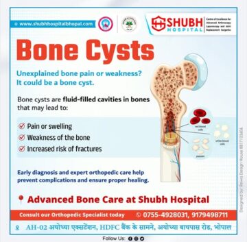 Advanced bone cyst treatment in Bhopal showing bone cyst structure