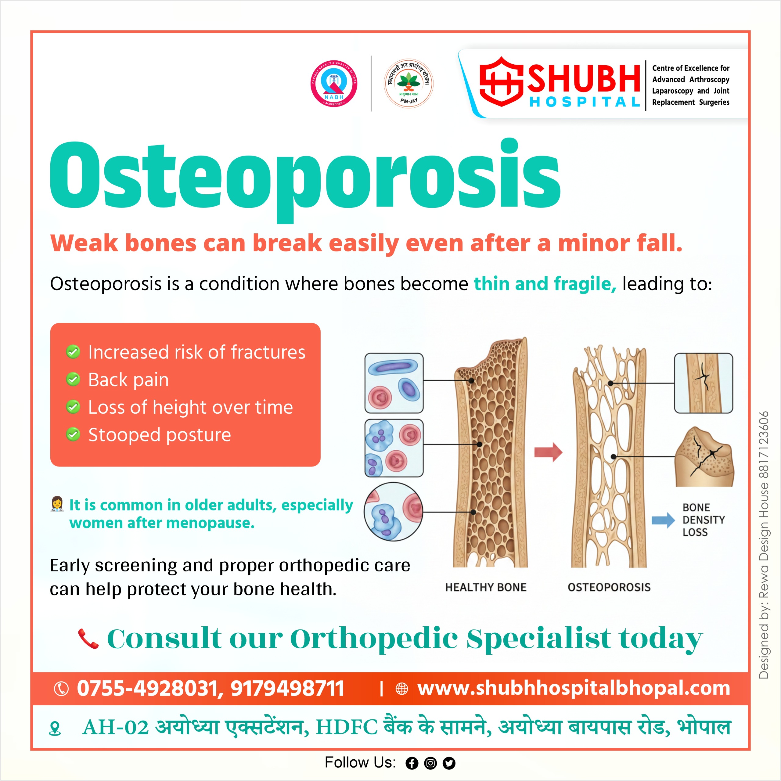 Best osteoporosis treatment in Bhopal showing healthy vs osteoporotic bone